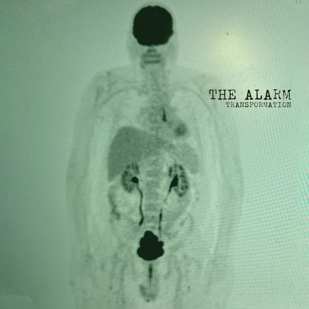 The Alarm - Transformation [Vinyl]