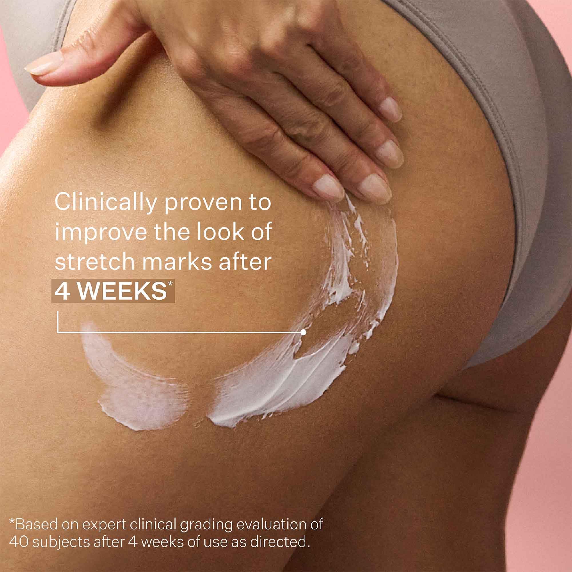 StriVectin SD Advanced Plus Intensive Moisturizer for Wrinkles & Stretchmarks | 120 ml | Unisex Adult 7
