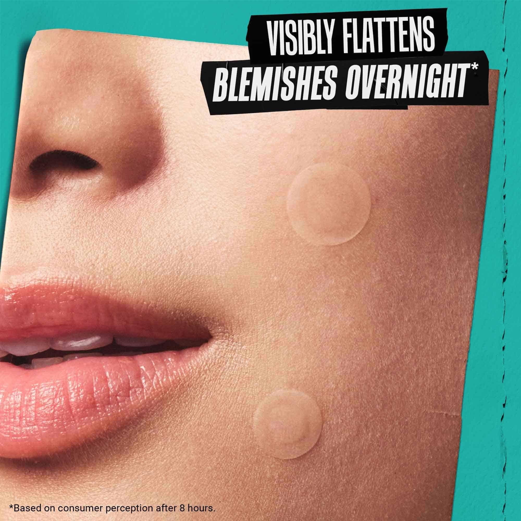 Kiehl's Overnight Blemish Patch - Hydrocolloid Spot Treatment for Blemishes | Unisex Adult 3